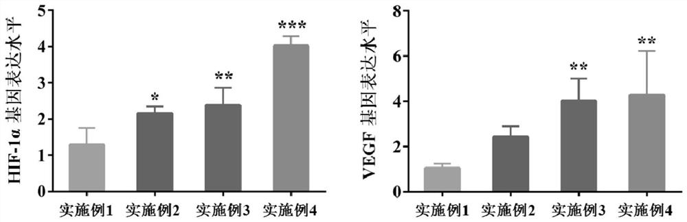 A kind of bioactive bone composite material and its preparation method and application