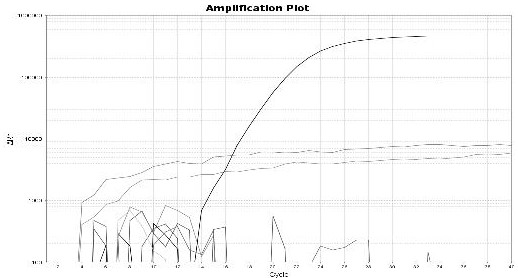 Novel E-type aviadenovirus Fiber fluorescent quantitative PCR detection kit and application thereof