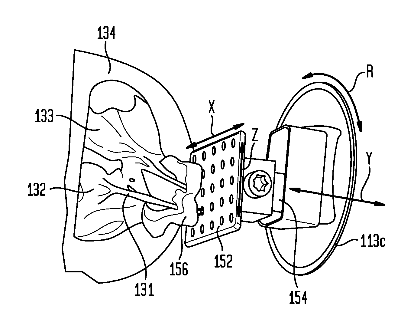 Simulated environment for transcatheter heart valve repair