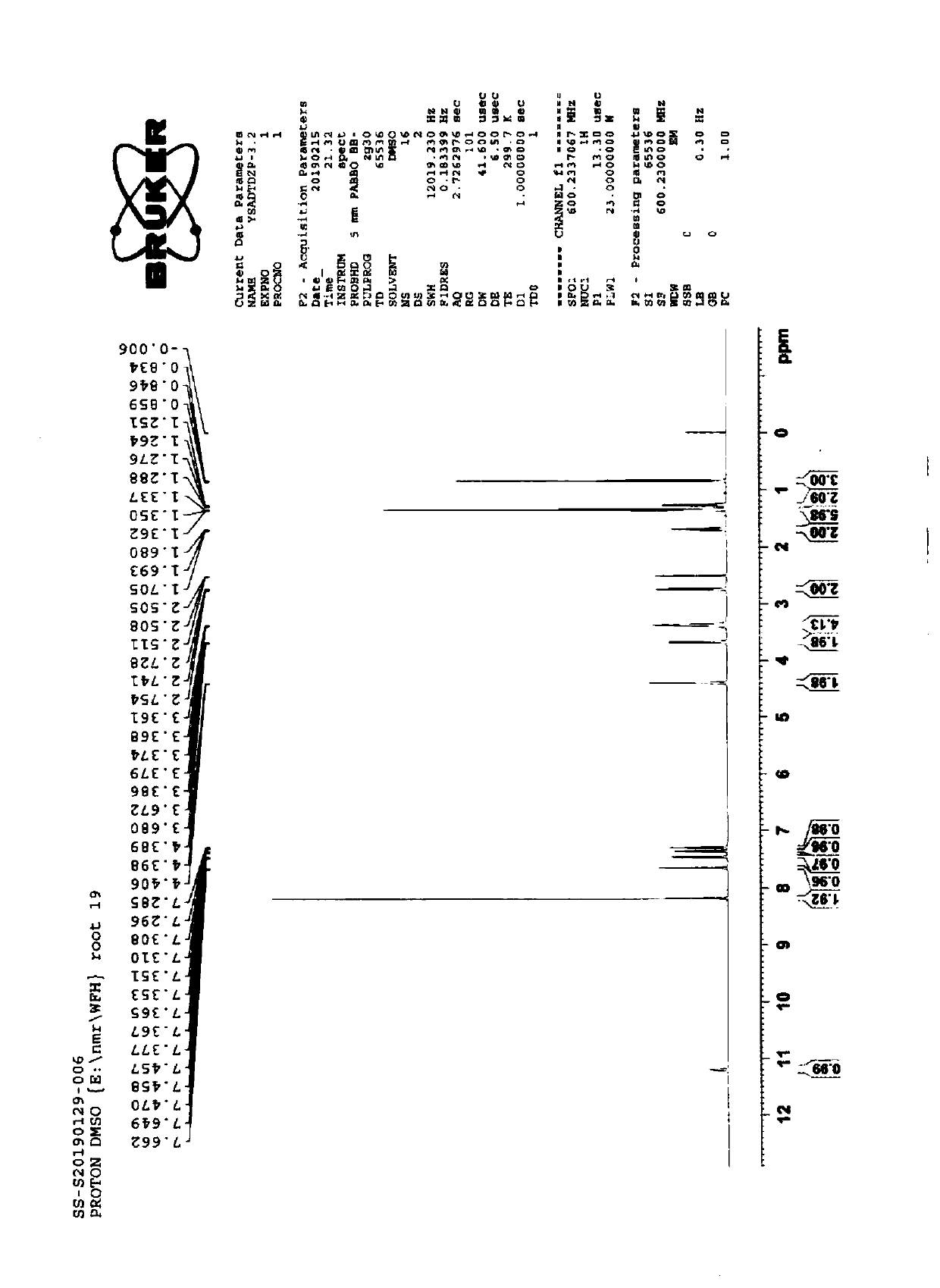 Preparation method of amiodarone hydrochloride