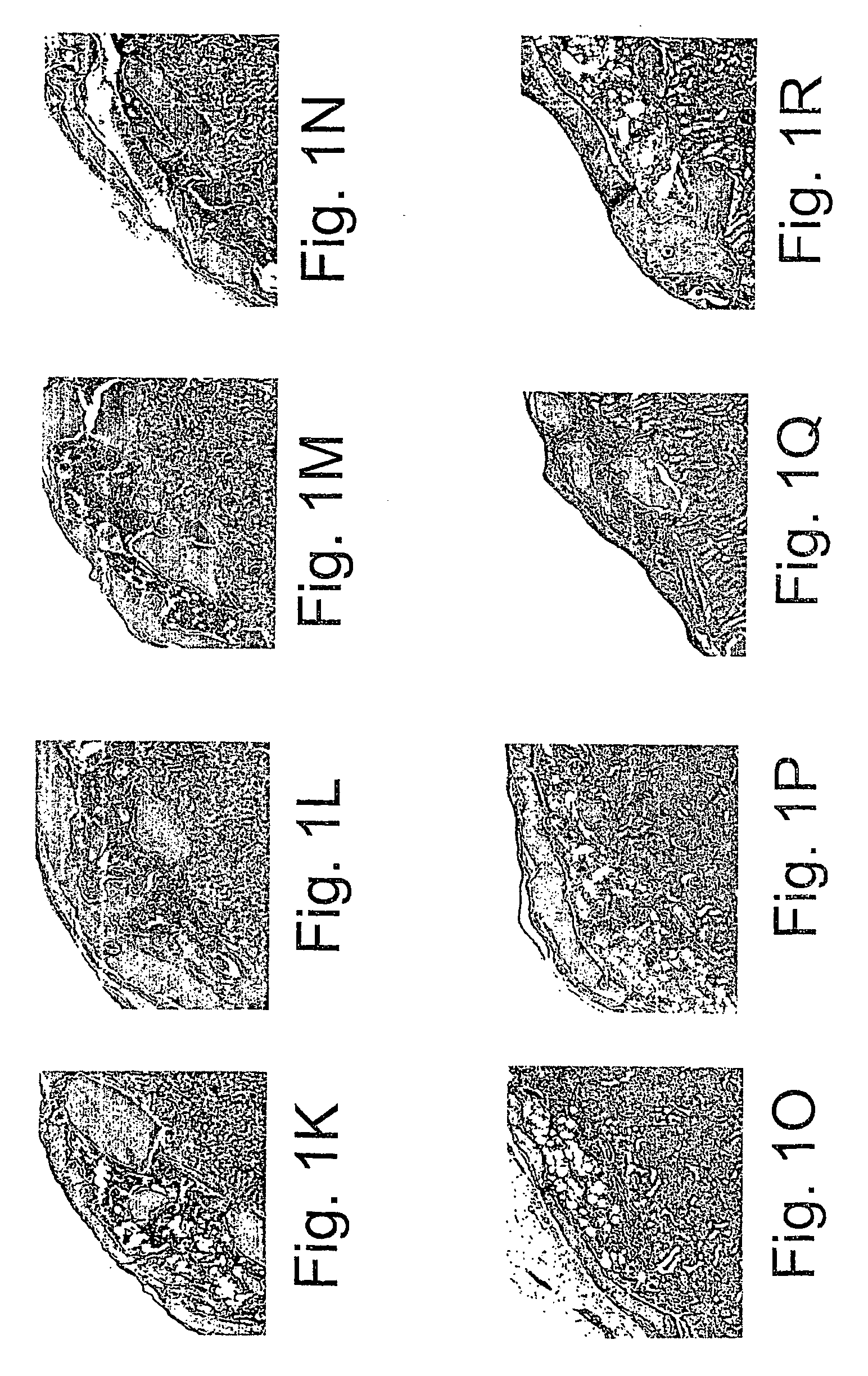 Compositions comprising bone marrow cells, demineralized bone matrix and various site-reactive polymers for use in the induction of bone and cartilage formation