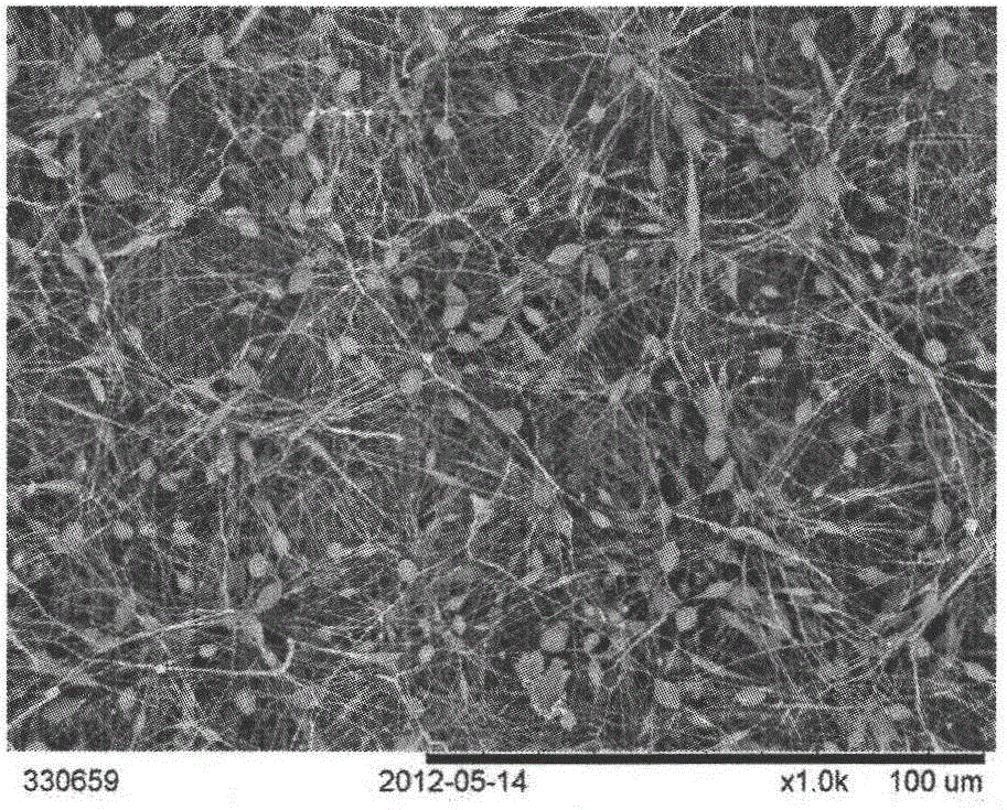 Preparation method of protein-grain-supported-in-beaded-fiber tissue engineering fiber support frame