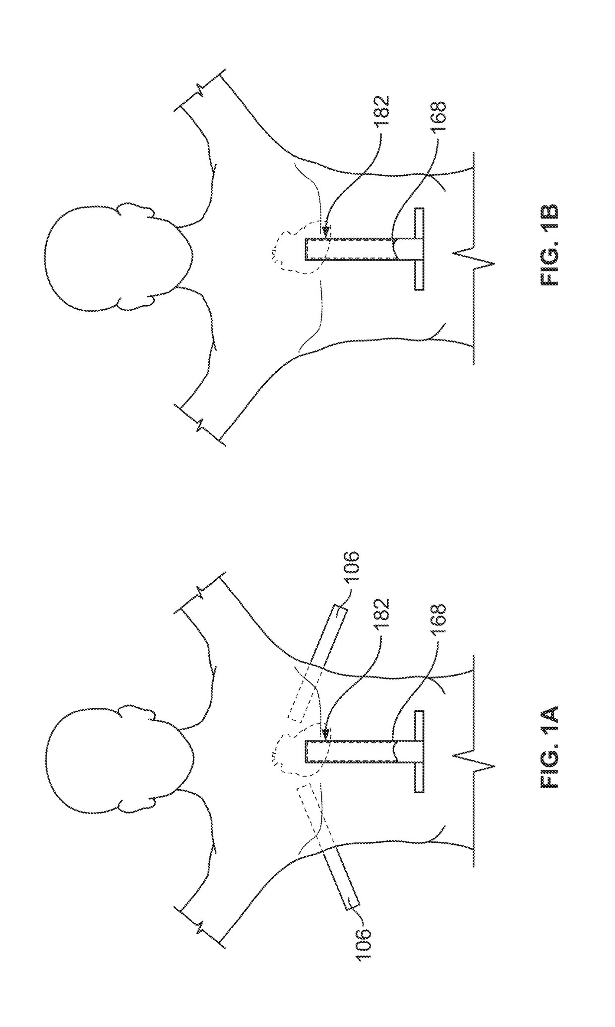 Diaphragm entry for posterior surgical access