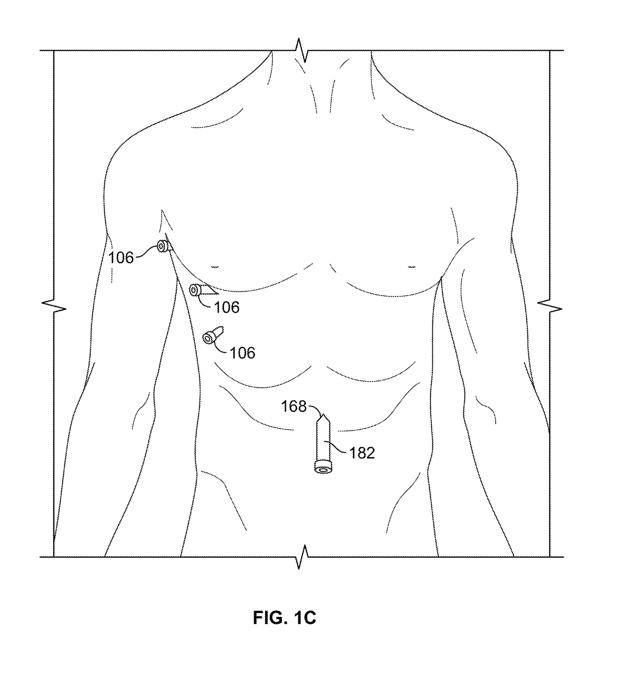 Diaphragm entry for posterior surgical access