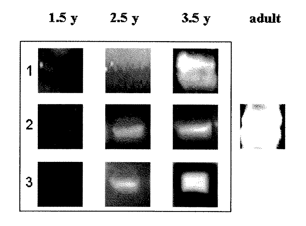 Protein-based streptococcus pneumoniae vaccines