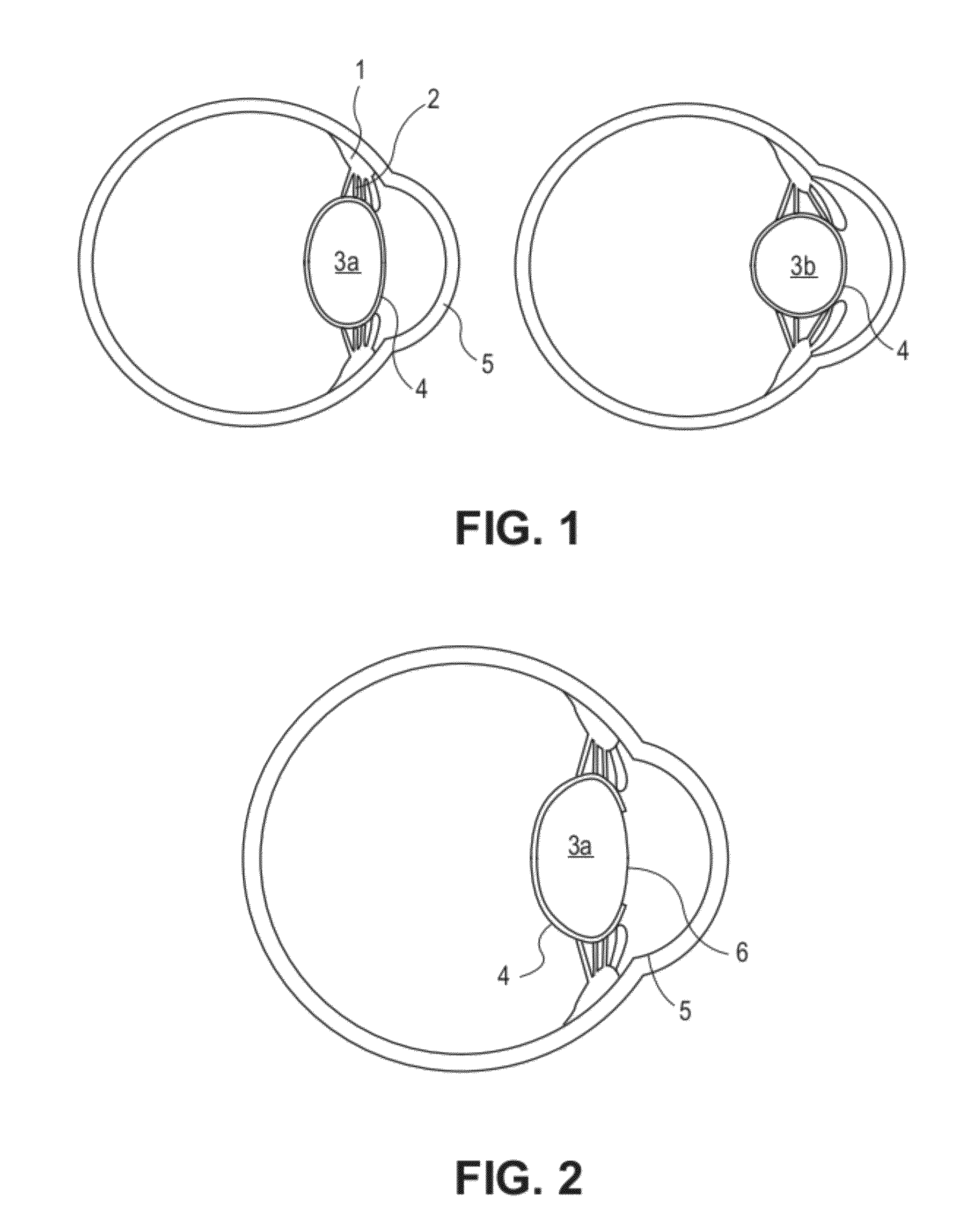 Accommodating intraocular lens