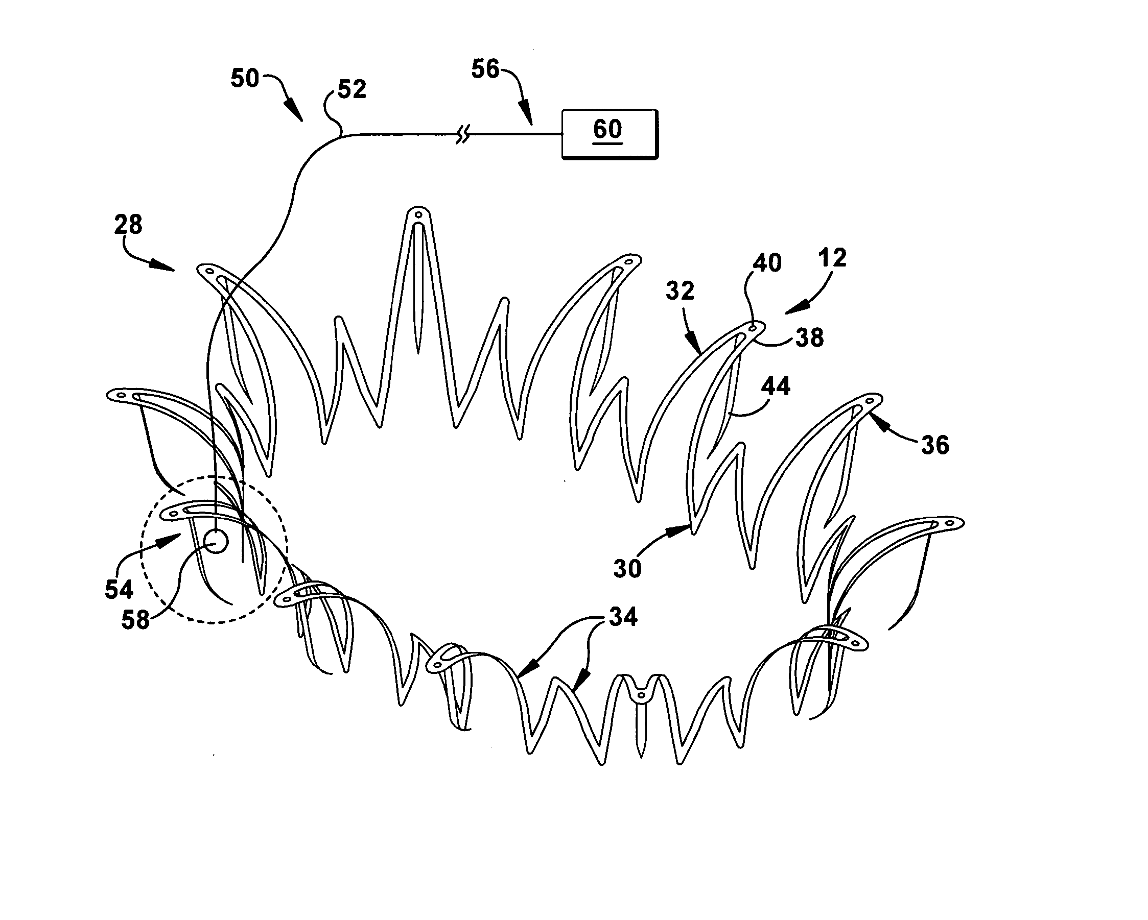 Apparatus and methods for repair of a cardiac valve