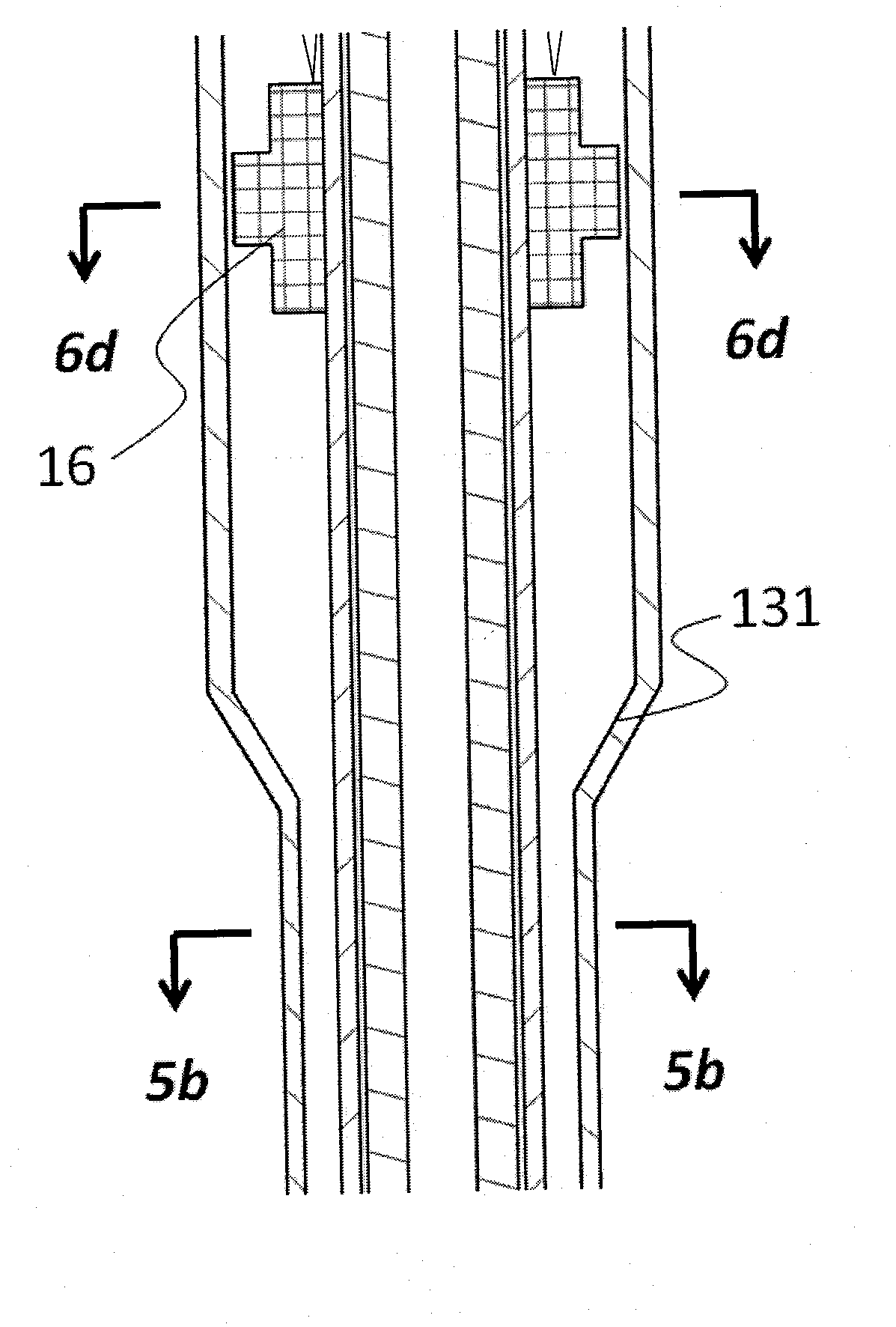 Percutaneous aorta bracket or aortic valve bracket system with far-end protection