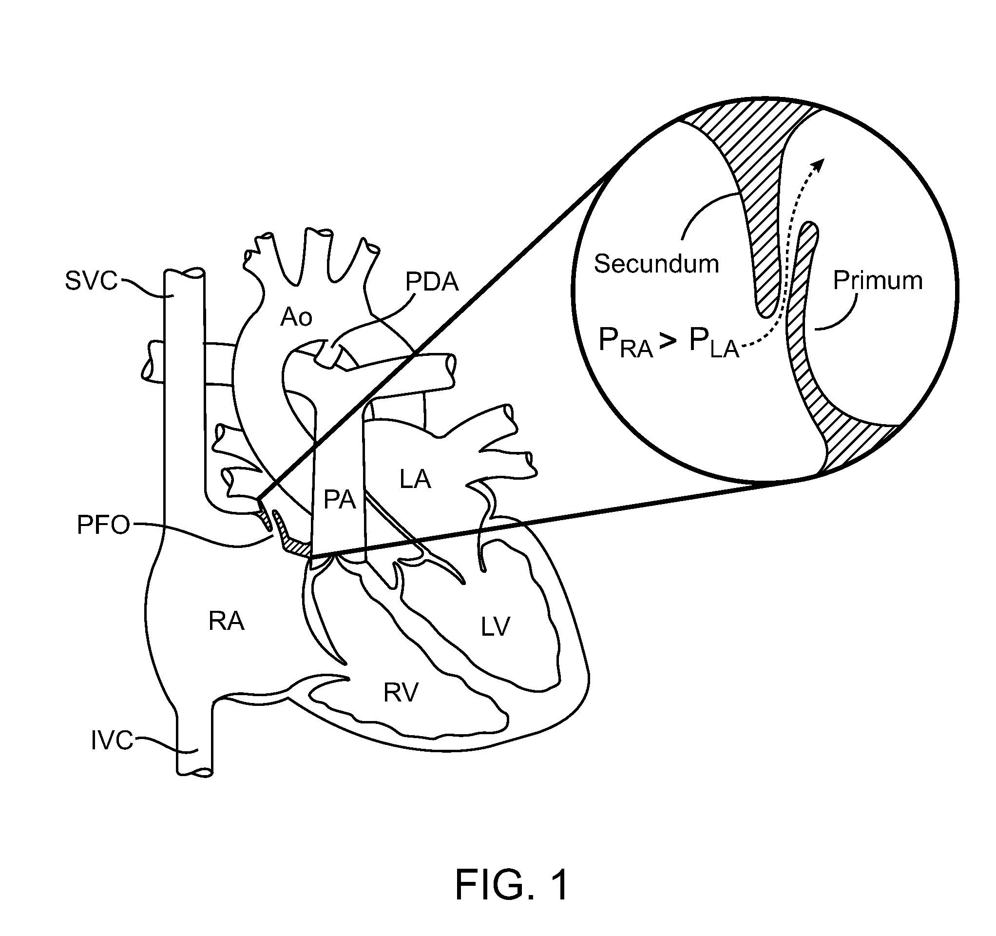 Multi-electrode apparatus for tissue welding and ablation