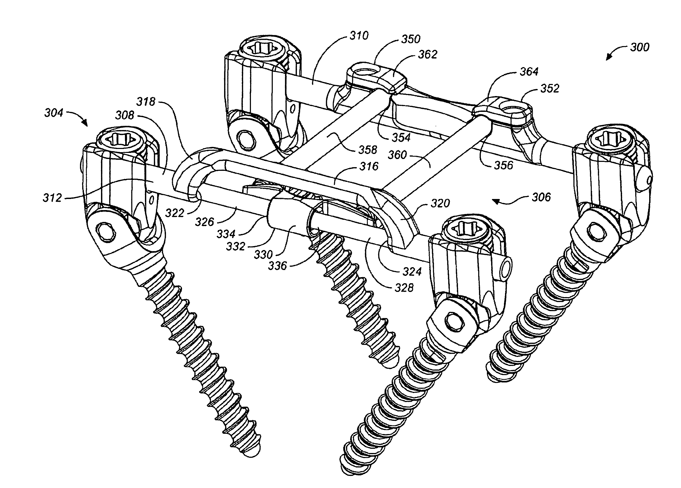 Deflection rod system for a dynamic stabilization and motion preservation spinal implantation system and method