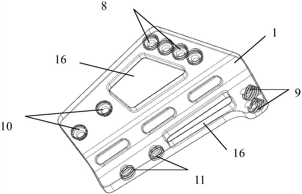 External fixation system for distal radius fracture