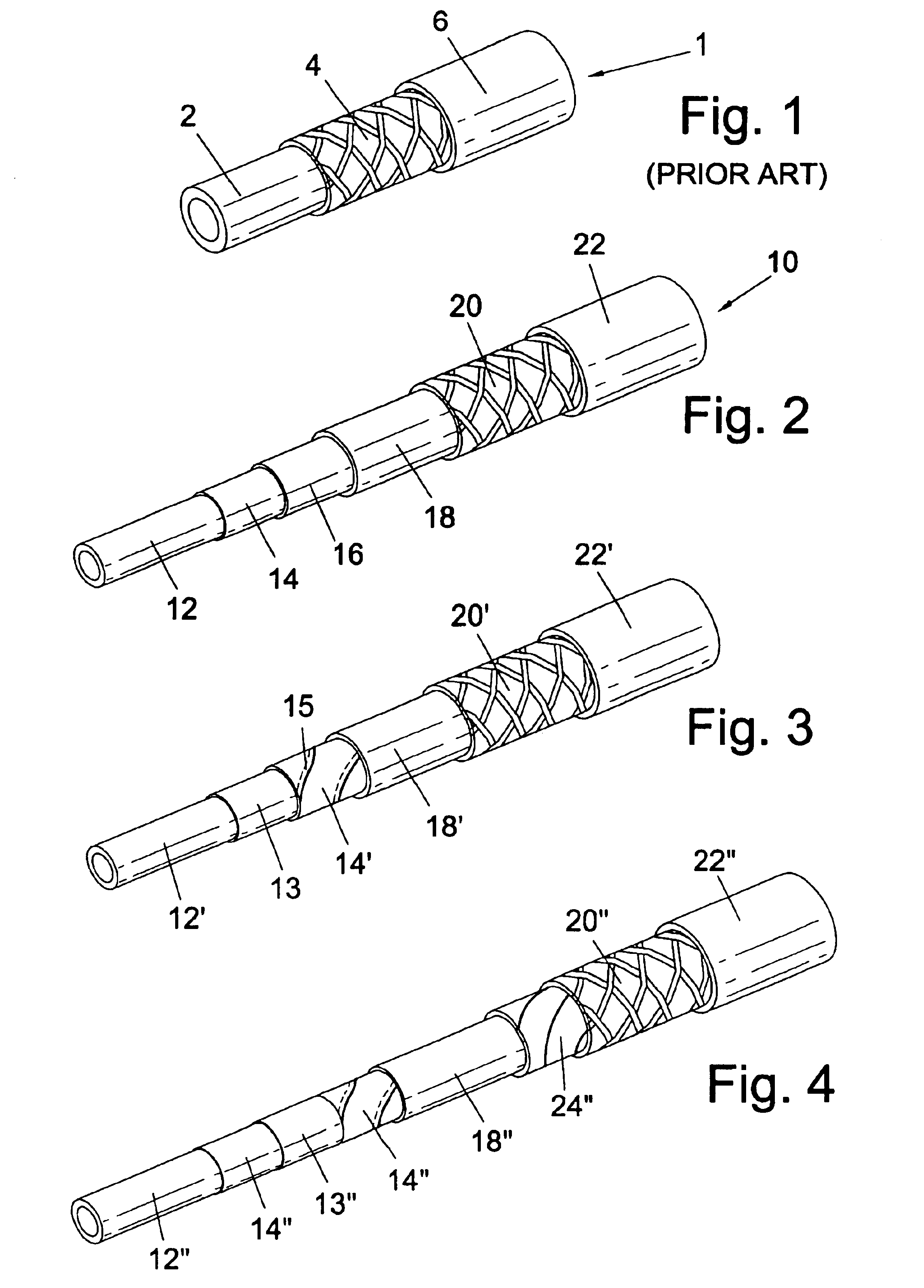 Fluid conduit