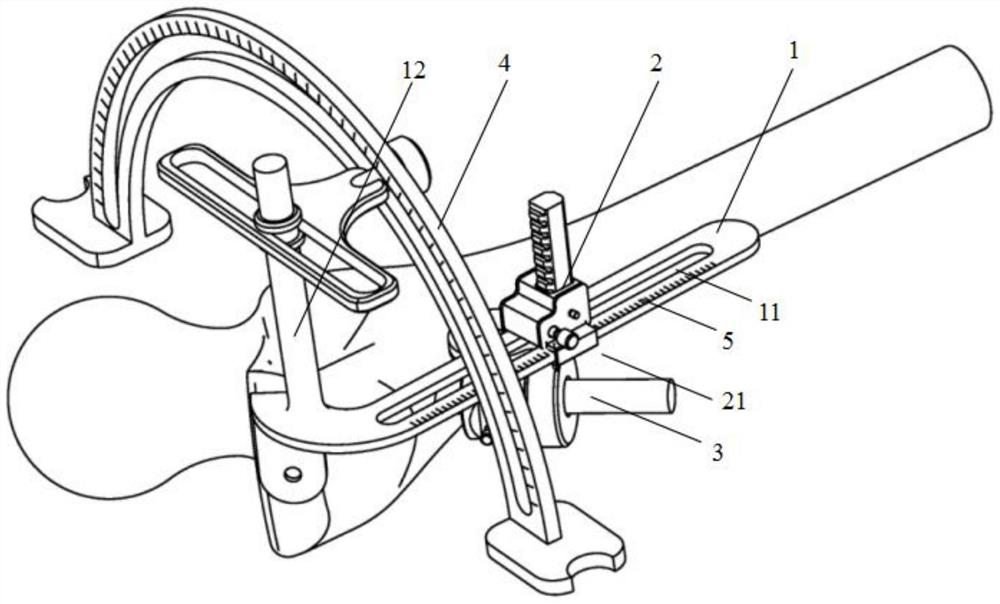 Femoral head external fixation drilling support