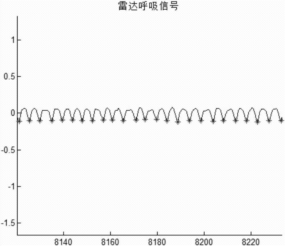 Non-contact sleep staging method