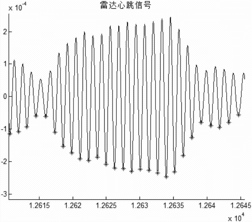 Non-contact sleep staging method