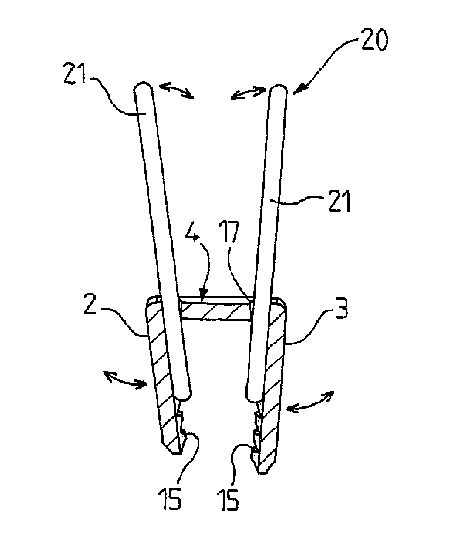 Compression Clip Having Convergent Legs