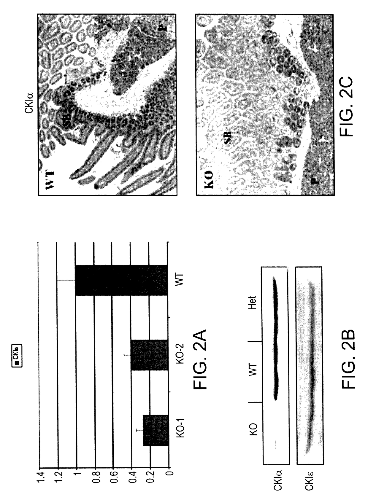 Methods of killing cells and use of same in prevention and treatment of cancer