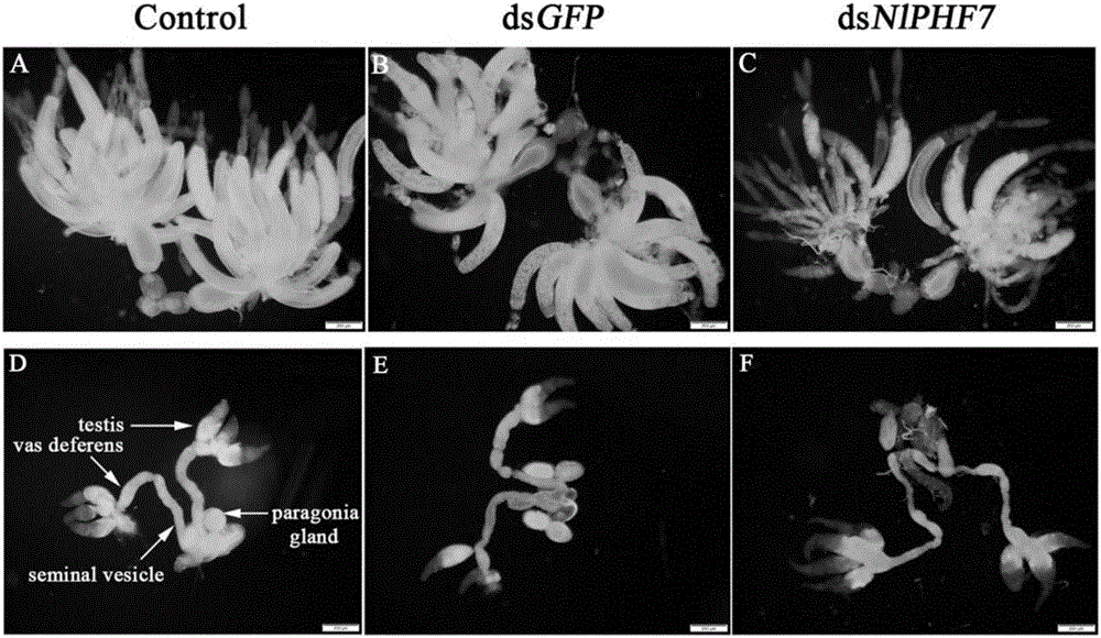 Breeding for brown planthopper population based on male sterilty after RNAi and control effect evaluation method