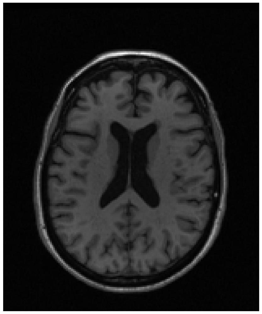 Image correlation detection method based on time sequence sparse regression and additive model