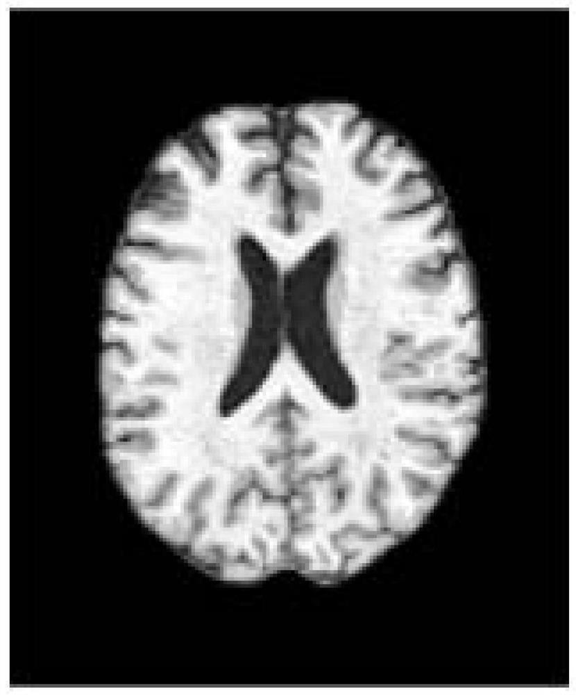 Image correlation detection method based on time sequence sparse regression and additive model