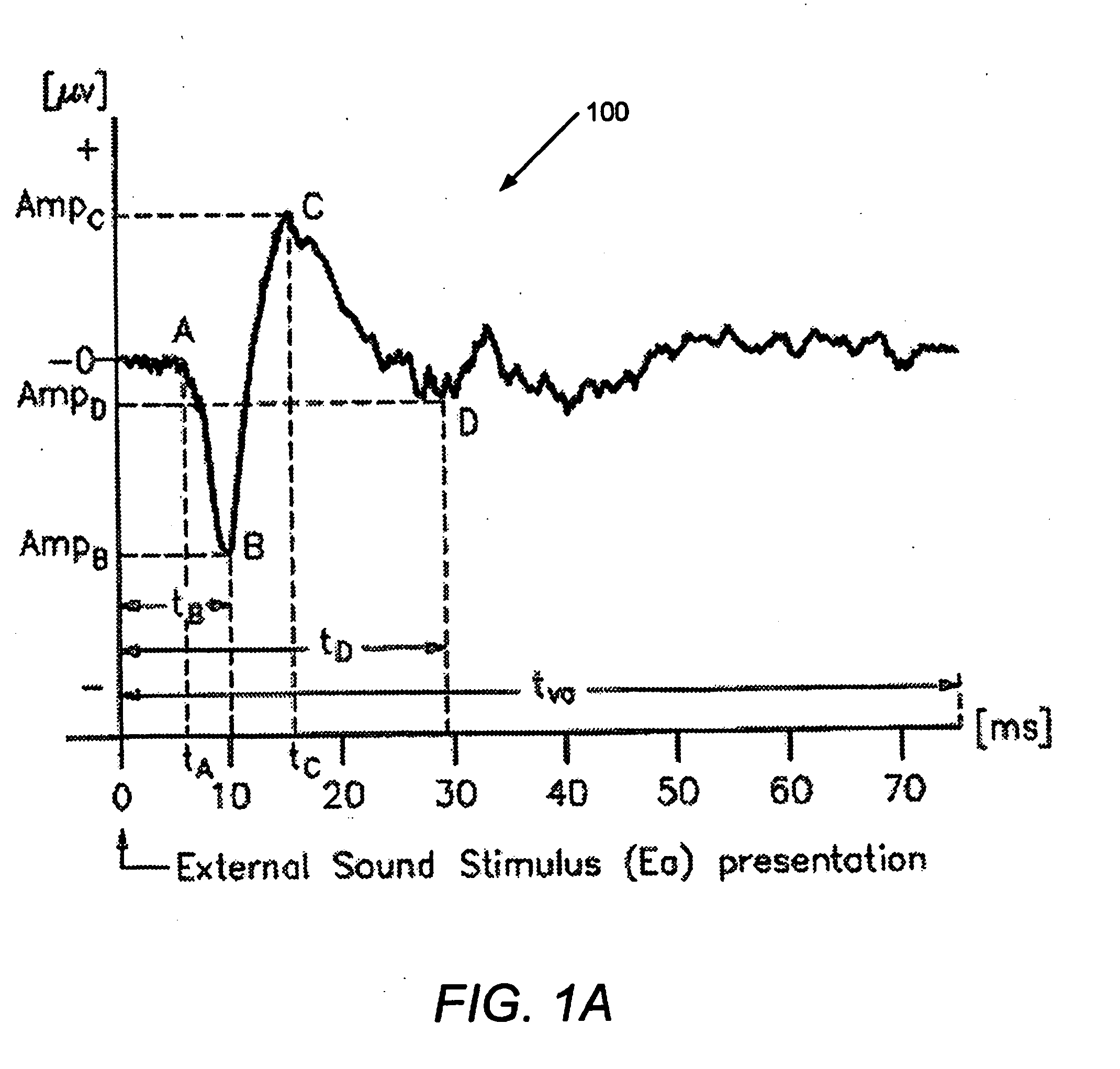 Systems and Methods for Detecting and Using an Electrical Cochlear Response ("ECR") in Analyzing Operation of a Cochlear Stimulation System