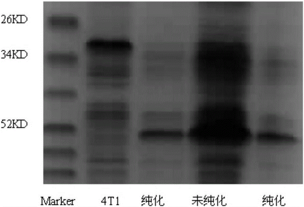 Human tissue kallikrein activity detection kit and its application