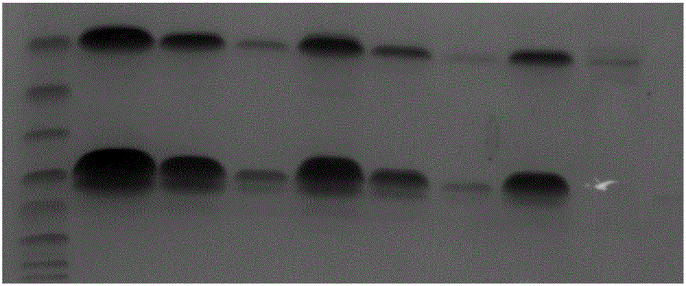 Human tissue kallikrein activity detection kit and its application