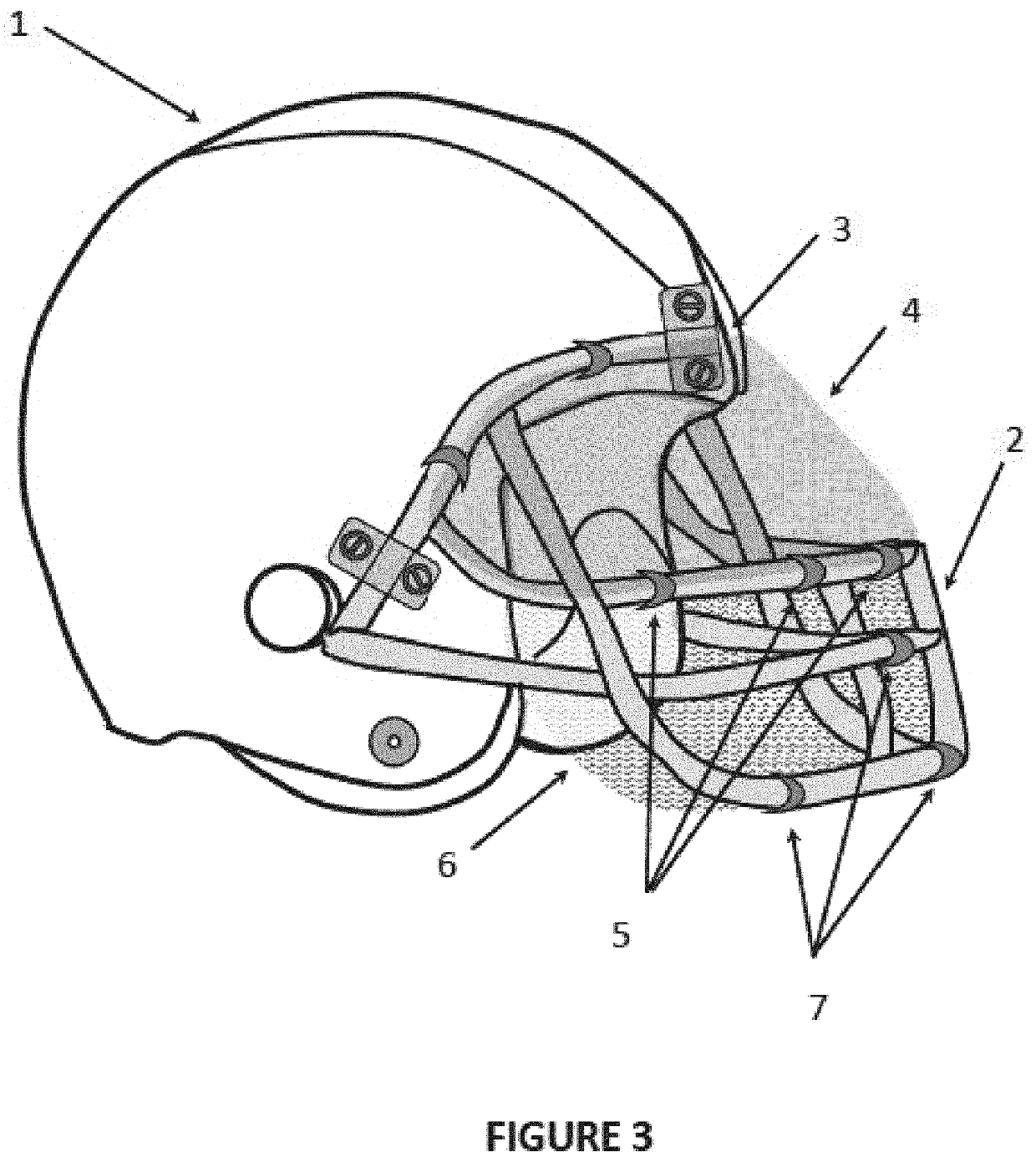 Sports Protection Accessory with Attachable Face Mask