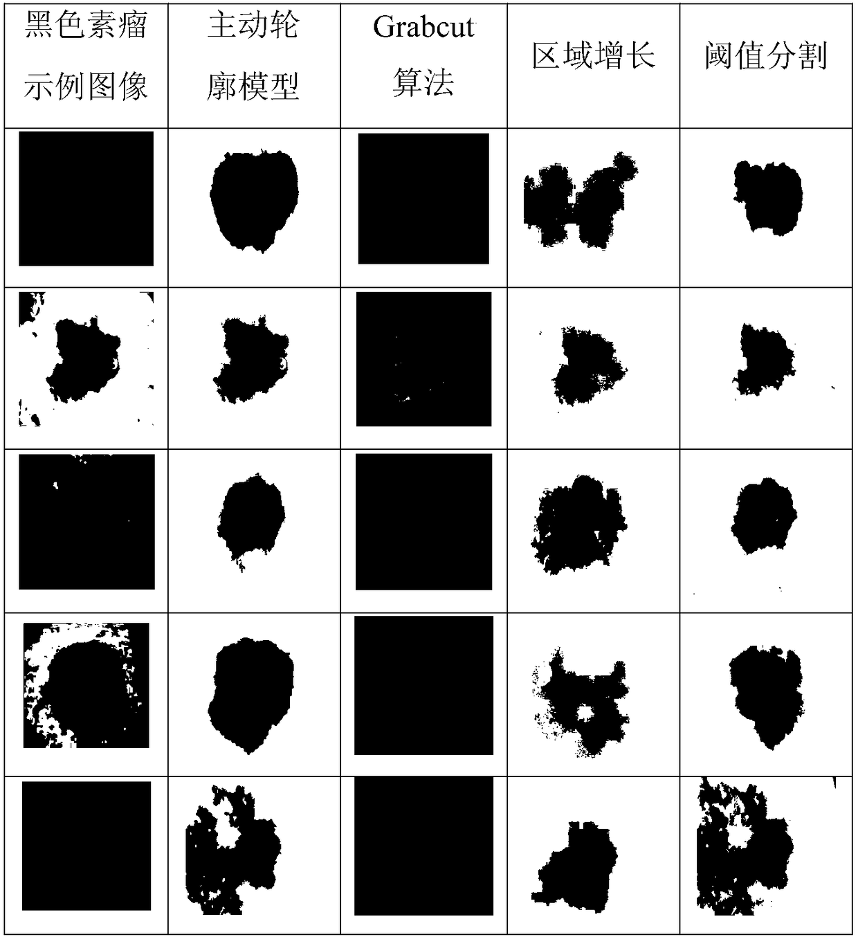 Melanoma auxiliary diagnosis method based on artificial intelligence