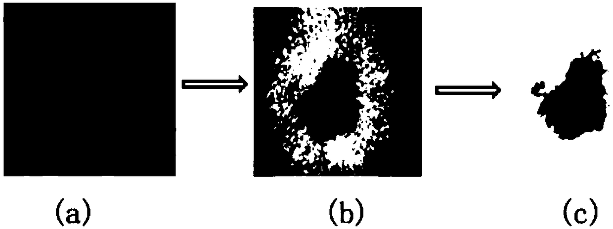 Melanoma auxiliary diagnosis method based on artificial intelligence