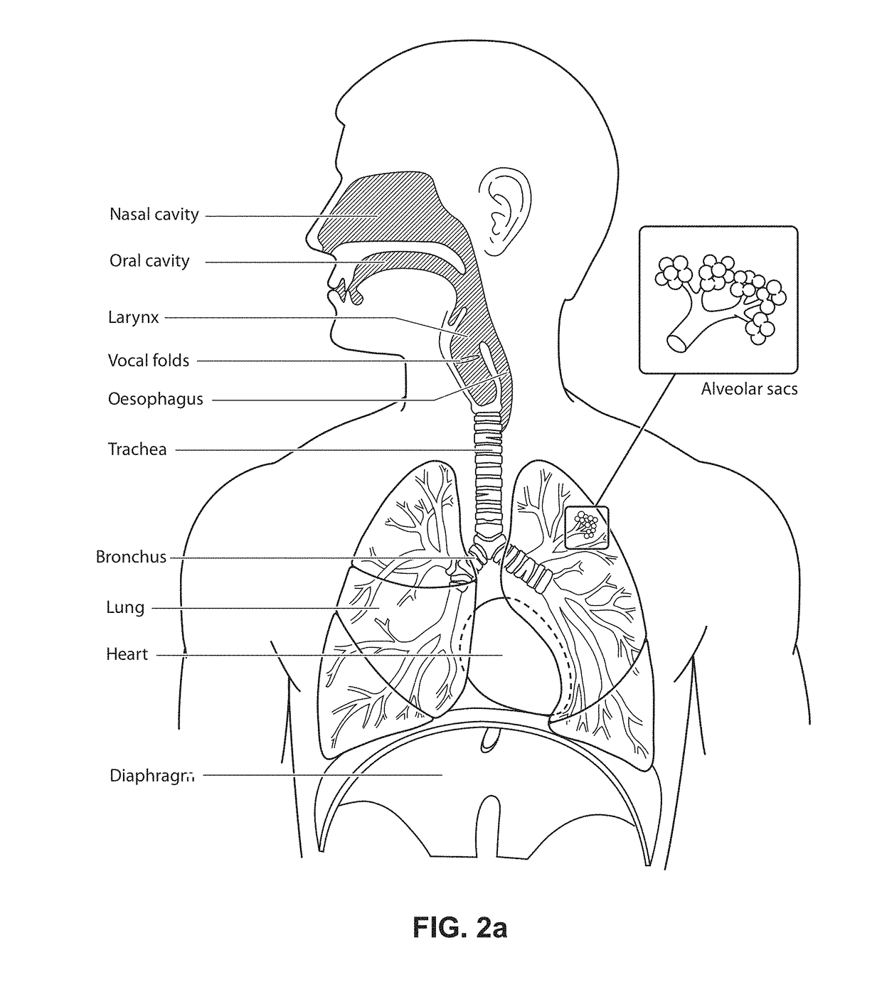 Nasal mask system