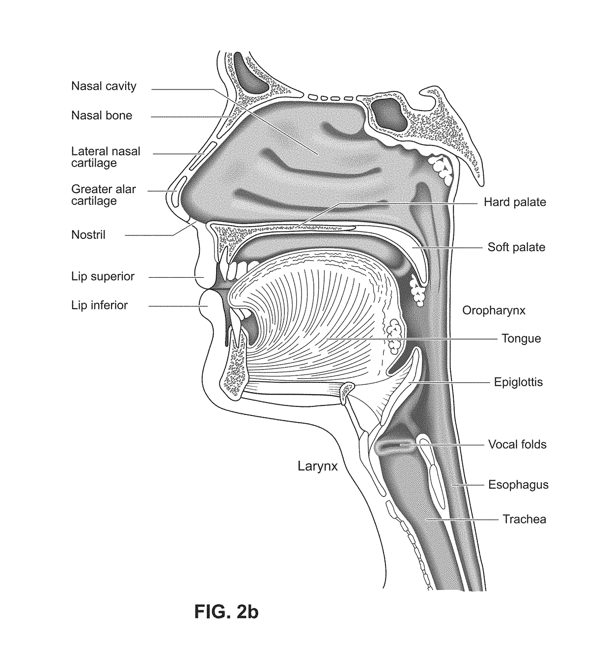 Nasal mask system