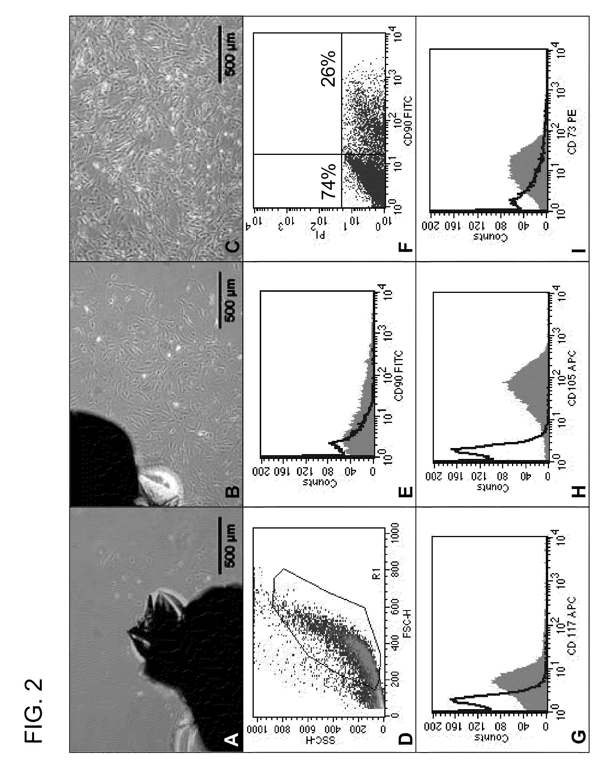 Cells for therapy of the heart, method of obtaining a cell preparation, and cell preparation