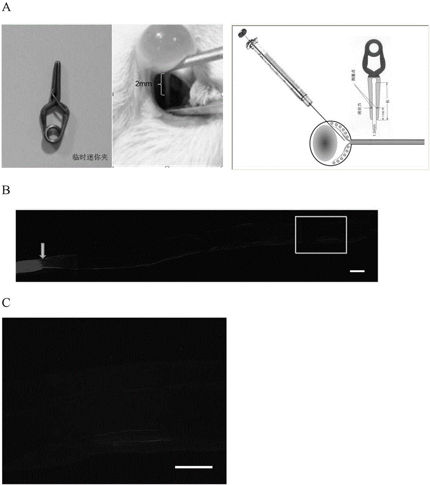 Pim-1 gene-containing adeno-associated virus 2 and application thereof to repairing of injured optic nerve