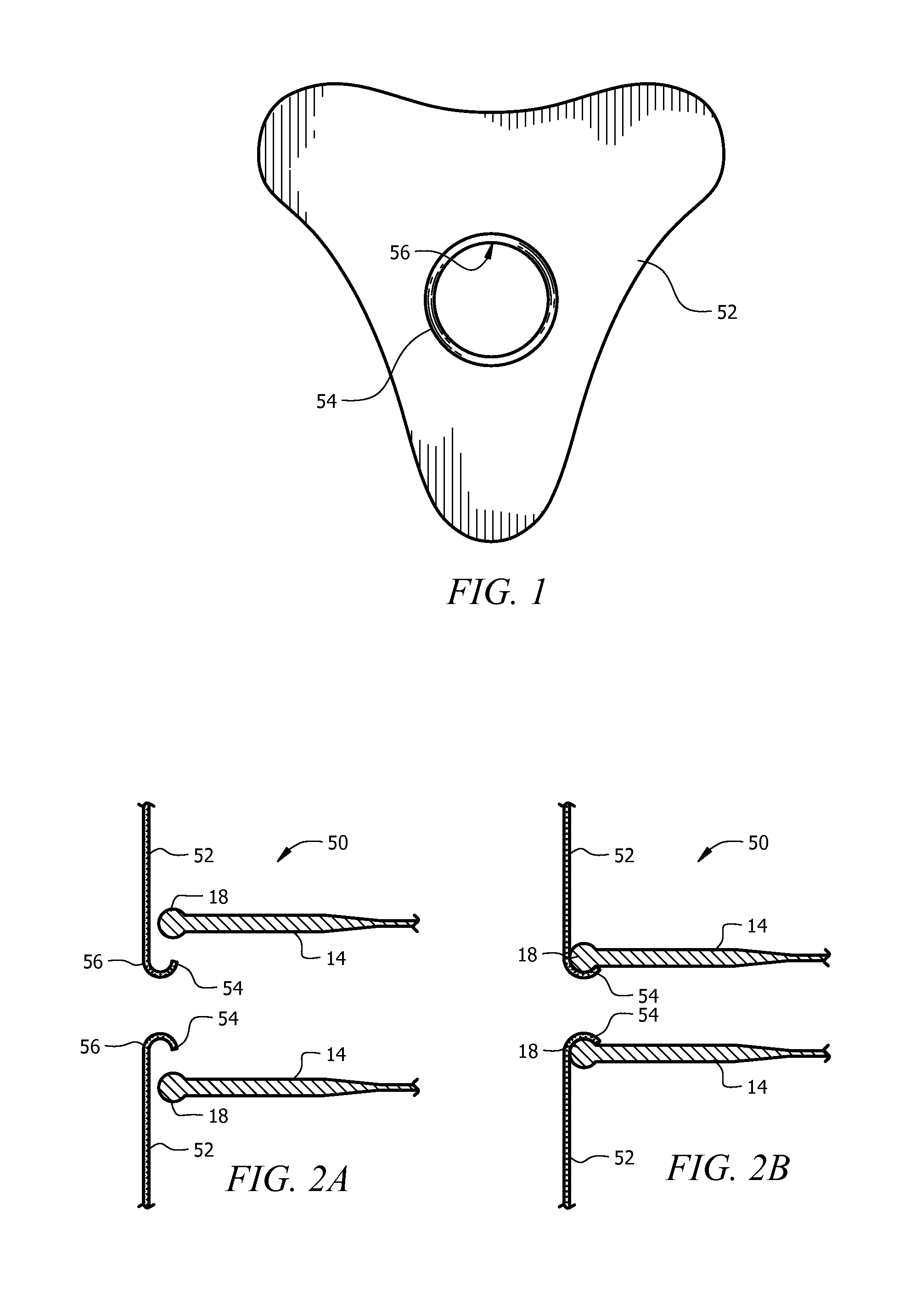 Sexually transmitted disease shield and condom