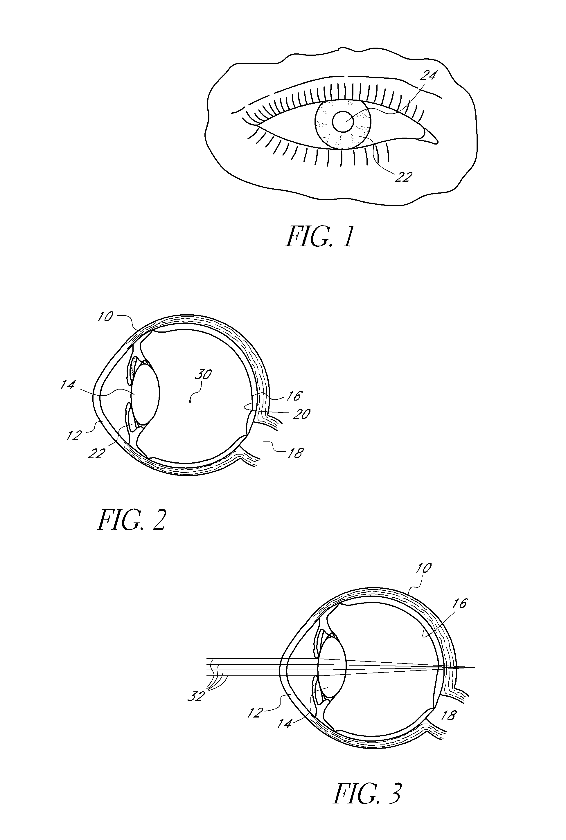 Ocular mask having selective spectral transmission