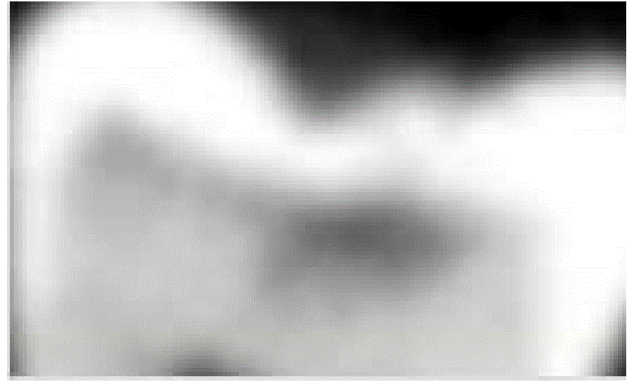 Dental caries image processing method based on extracted tooth CBCT