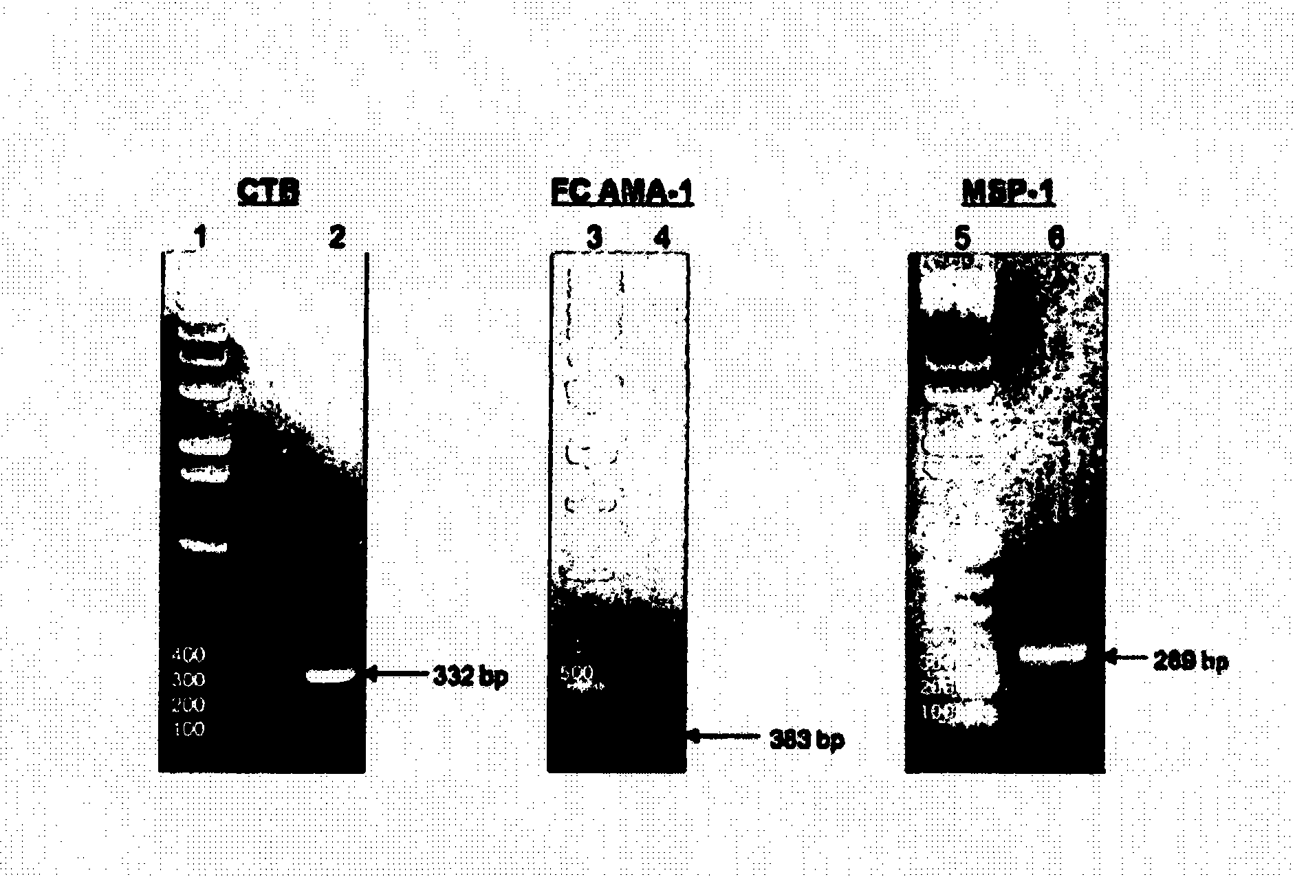 Chloroplast-derived human vaccine antigens against malaria