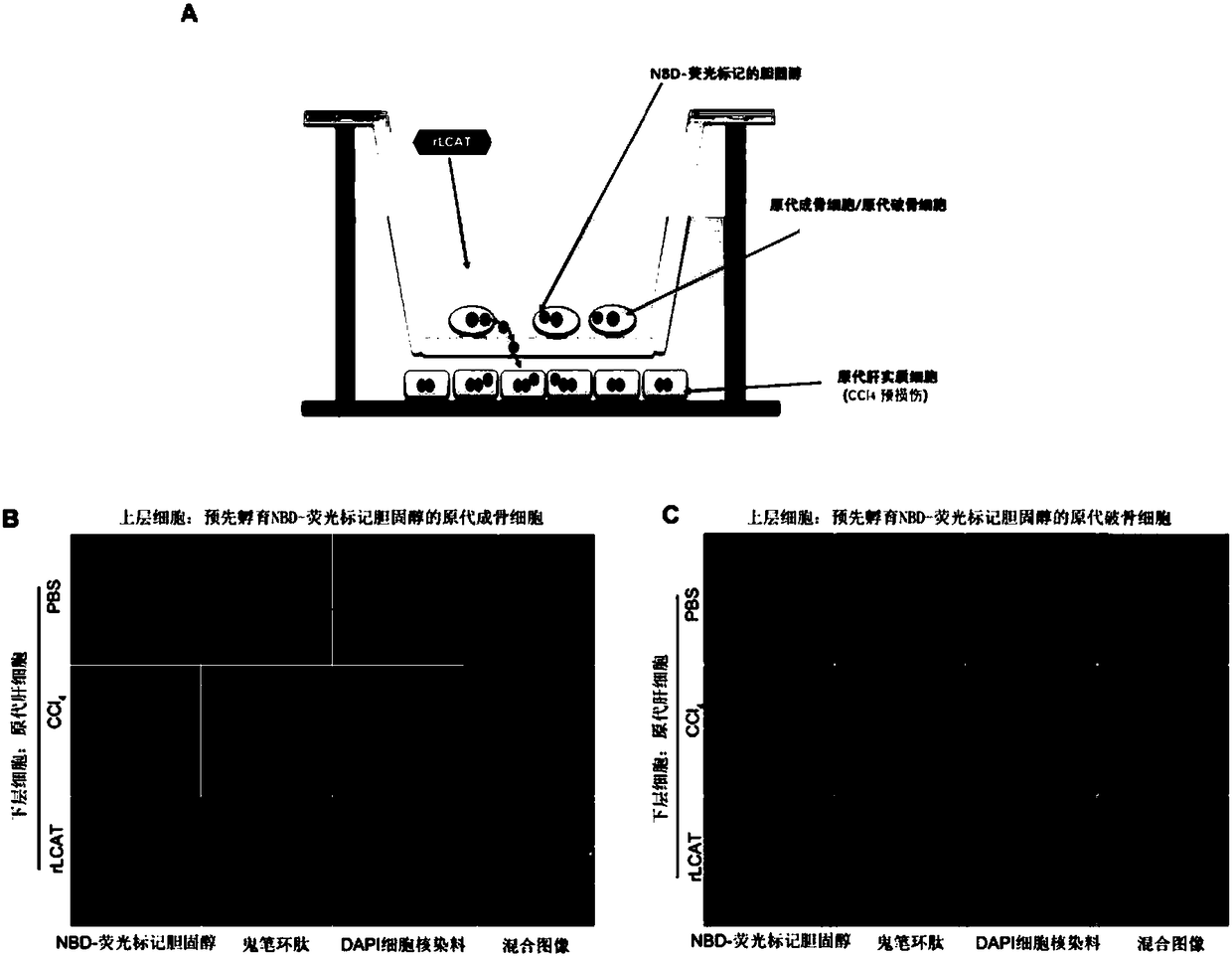 Use of LCAT in preparing drug for treating and/or preventing hepatic bone disease