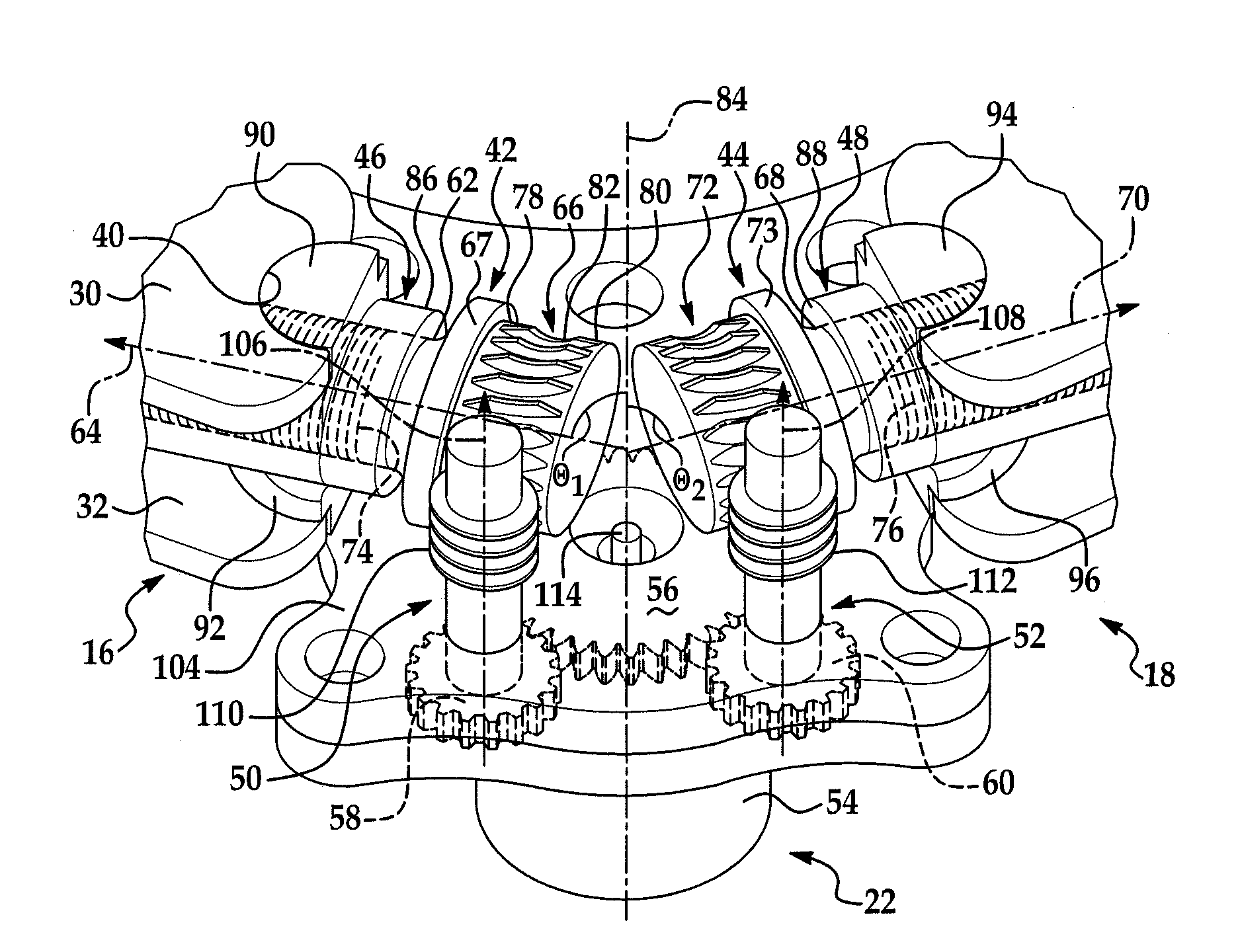 Variable position anchor assembly for adjusting brake shoes in a drum brake