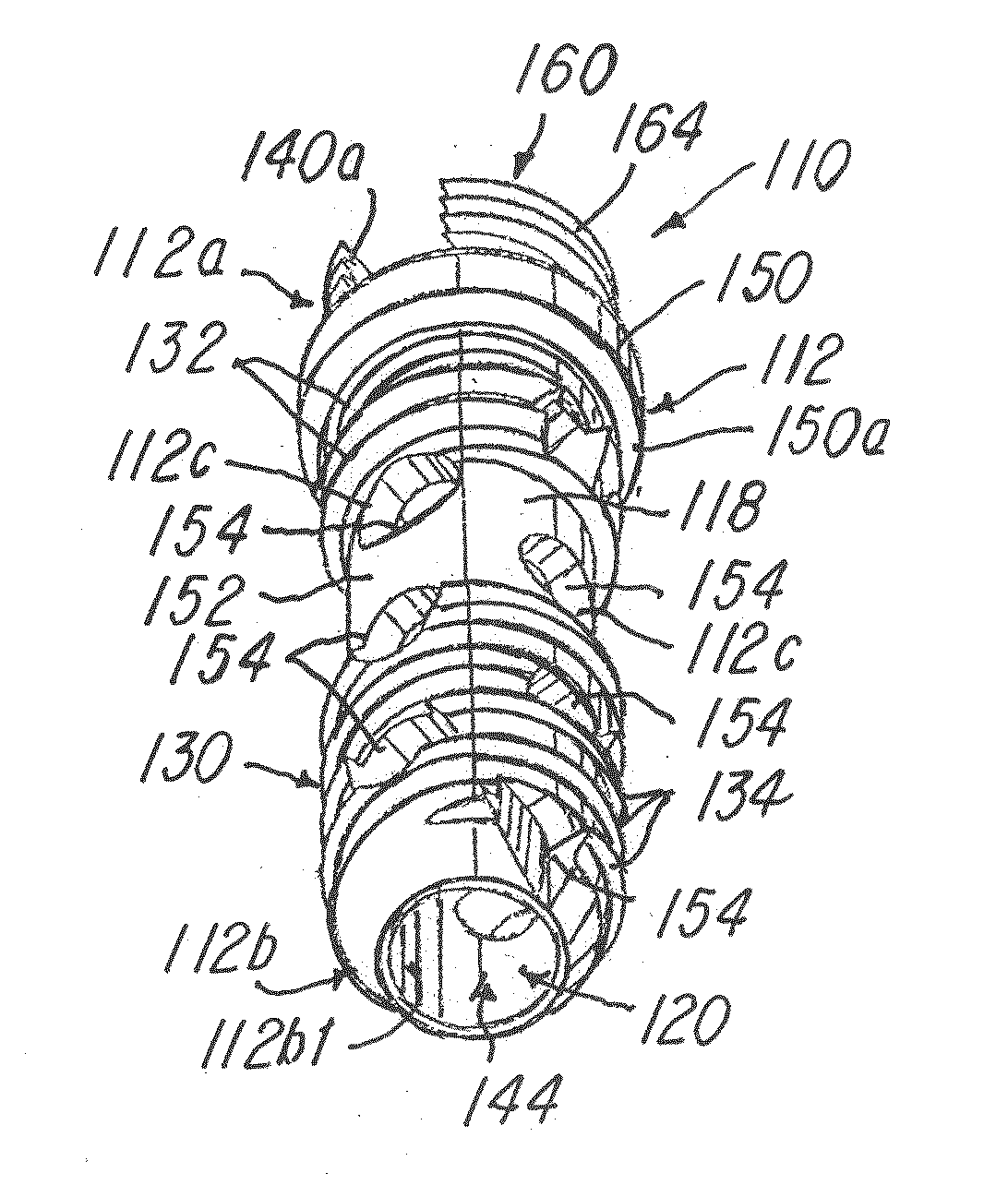 Minimally invasive spinal facet compression screw and system for bone joint fusion and fixation