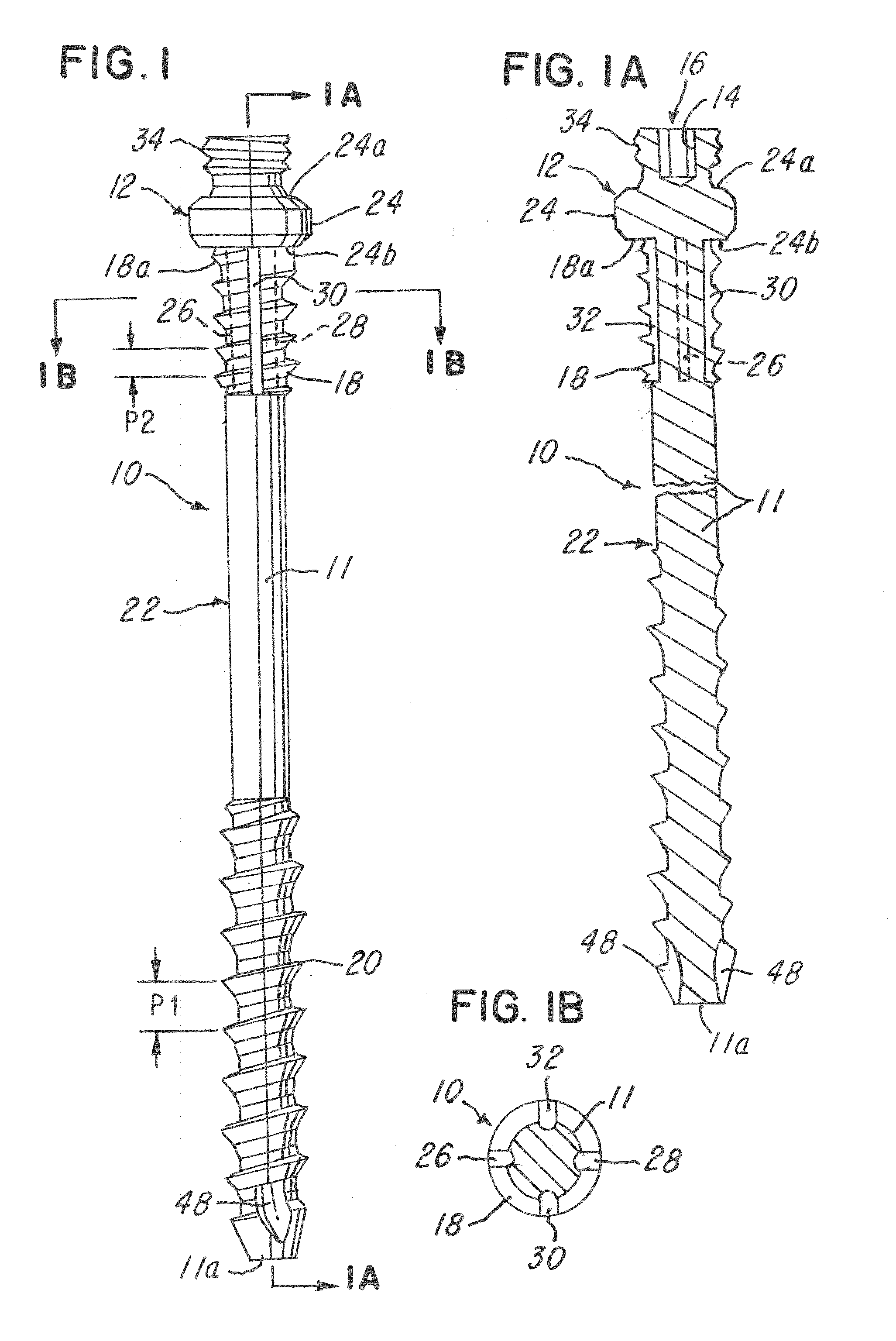 Minimally invasive spinal facet compression screw and system for bone joint fusion and fixation