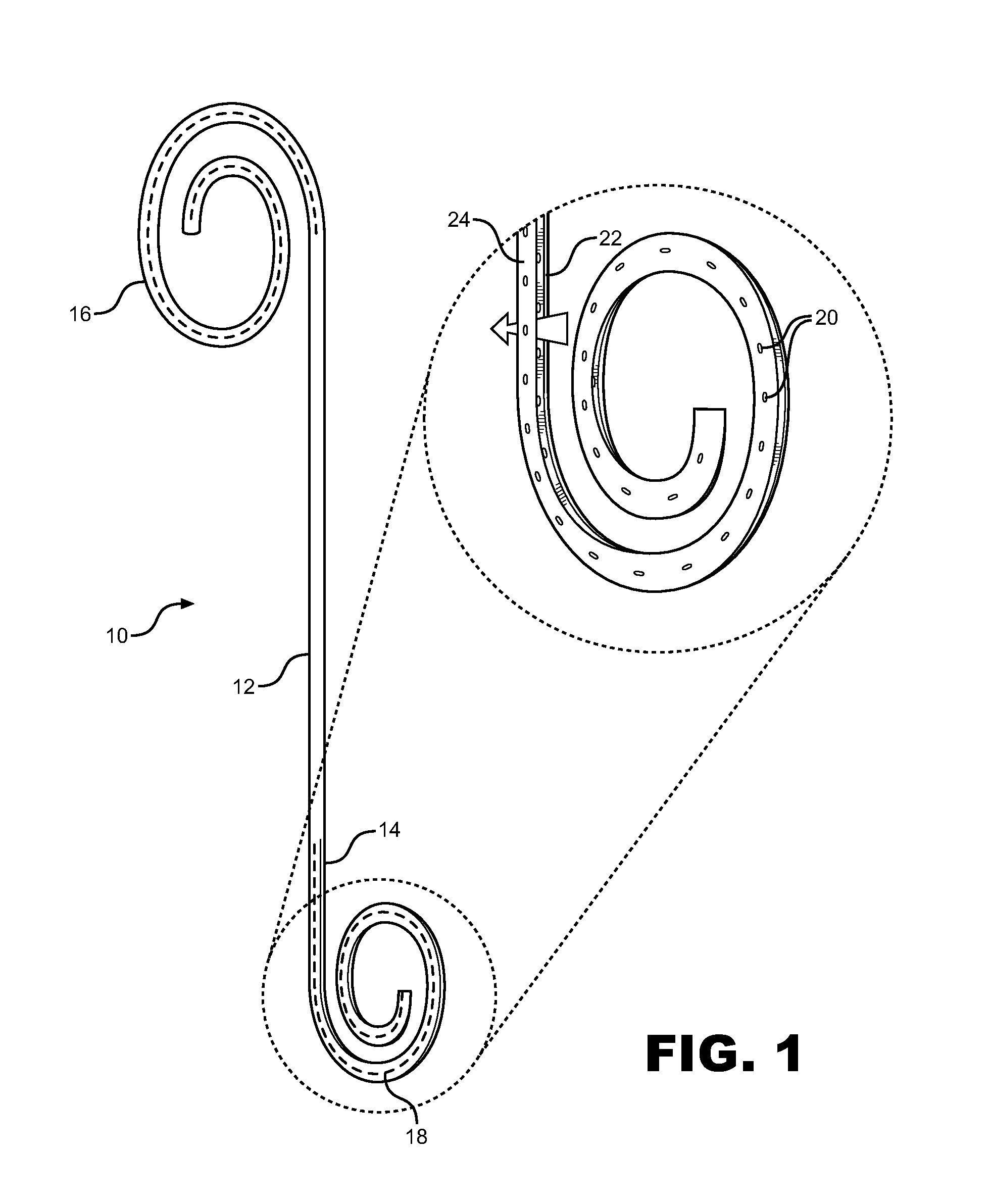 Anti-Refluxive and Trigone Sparing Internal Ureteral Stent