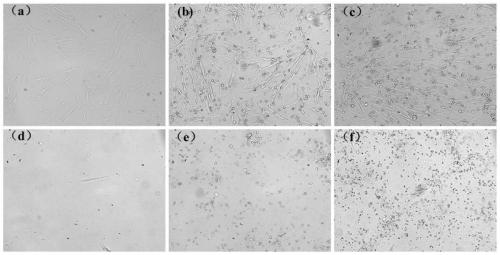 Controllable immortalized retrovirus vector and human umbilical cord mesenchymal stem cell and construction method thereof