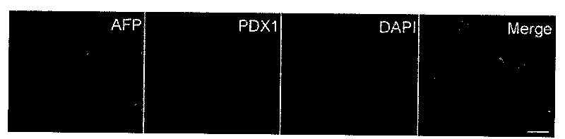 PDX1 positive entoderm cell and preparation method thereof