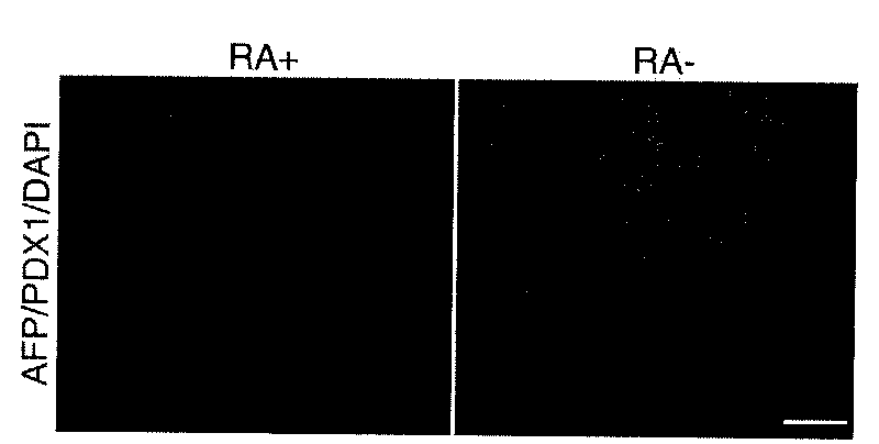 PDX1 positive entoderm cell and preparation method thereof