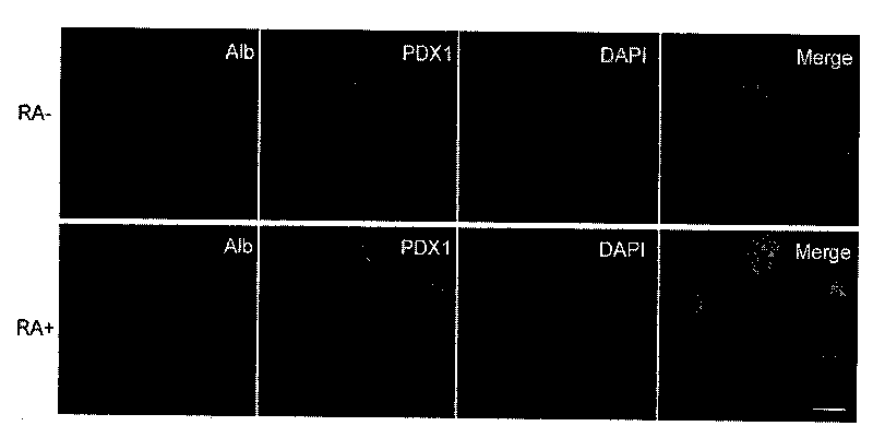 PDX1 positive entoderm cell and preparation method thereof