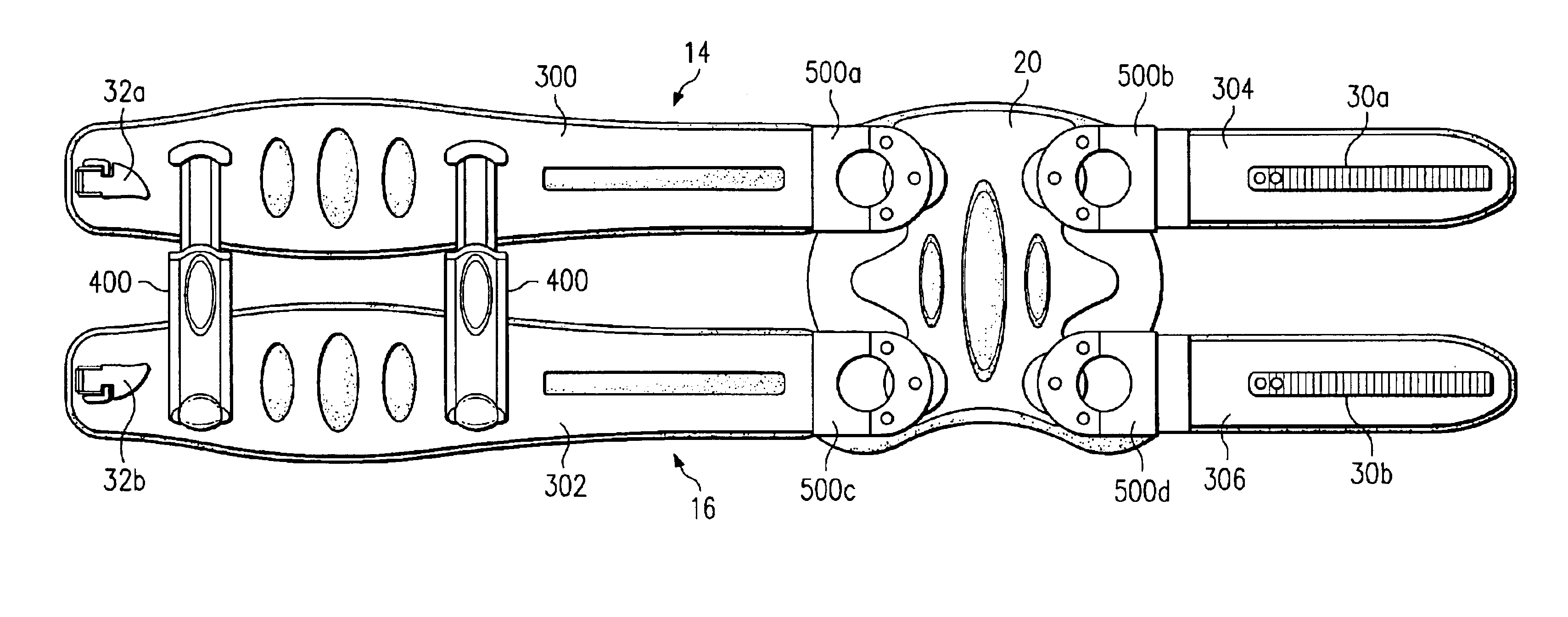 Dynamically adjustable stabilization brace