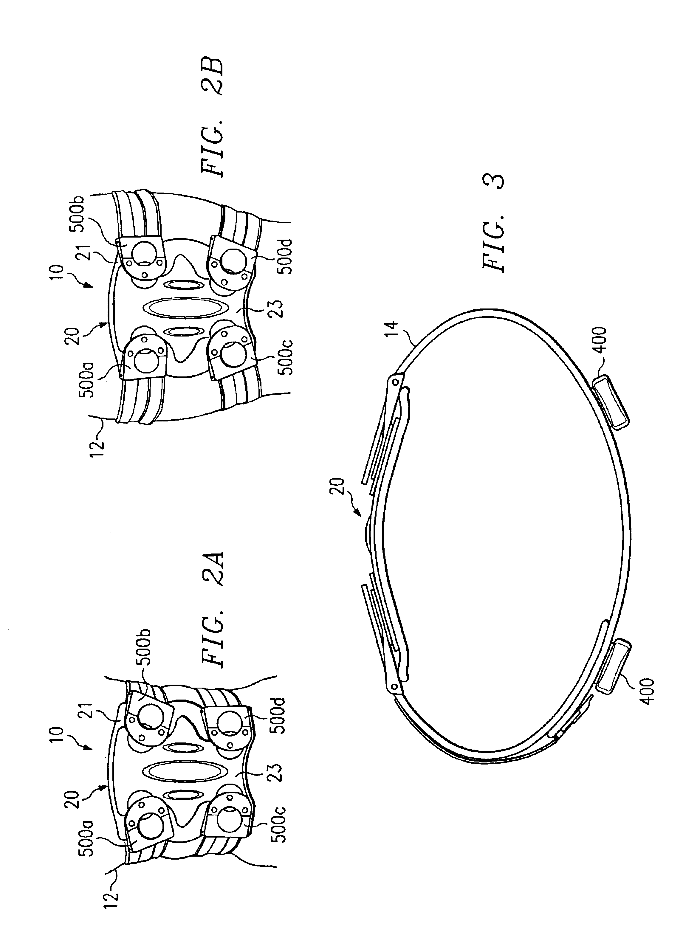 Dynamically adjustable stabilization brace