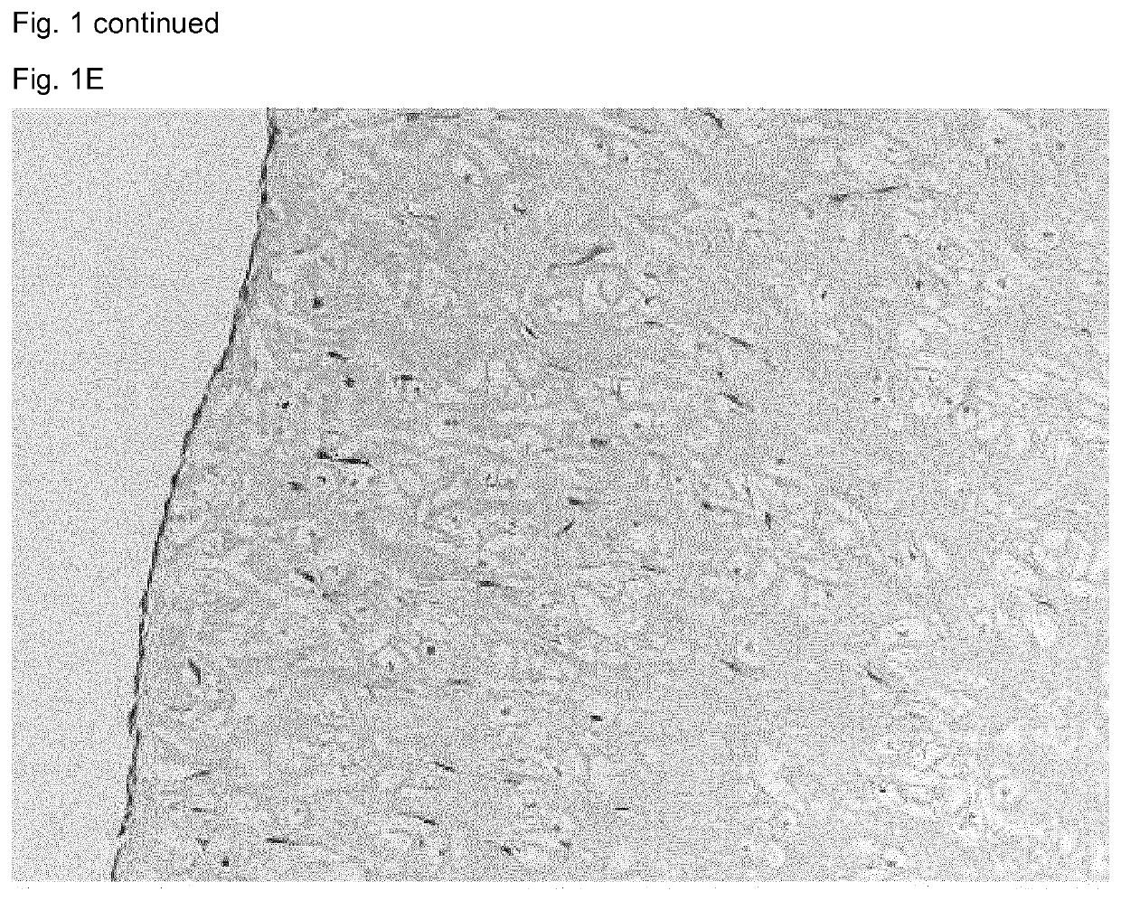 Elastin reduction allowing recellularization of cartilage implants